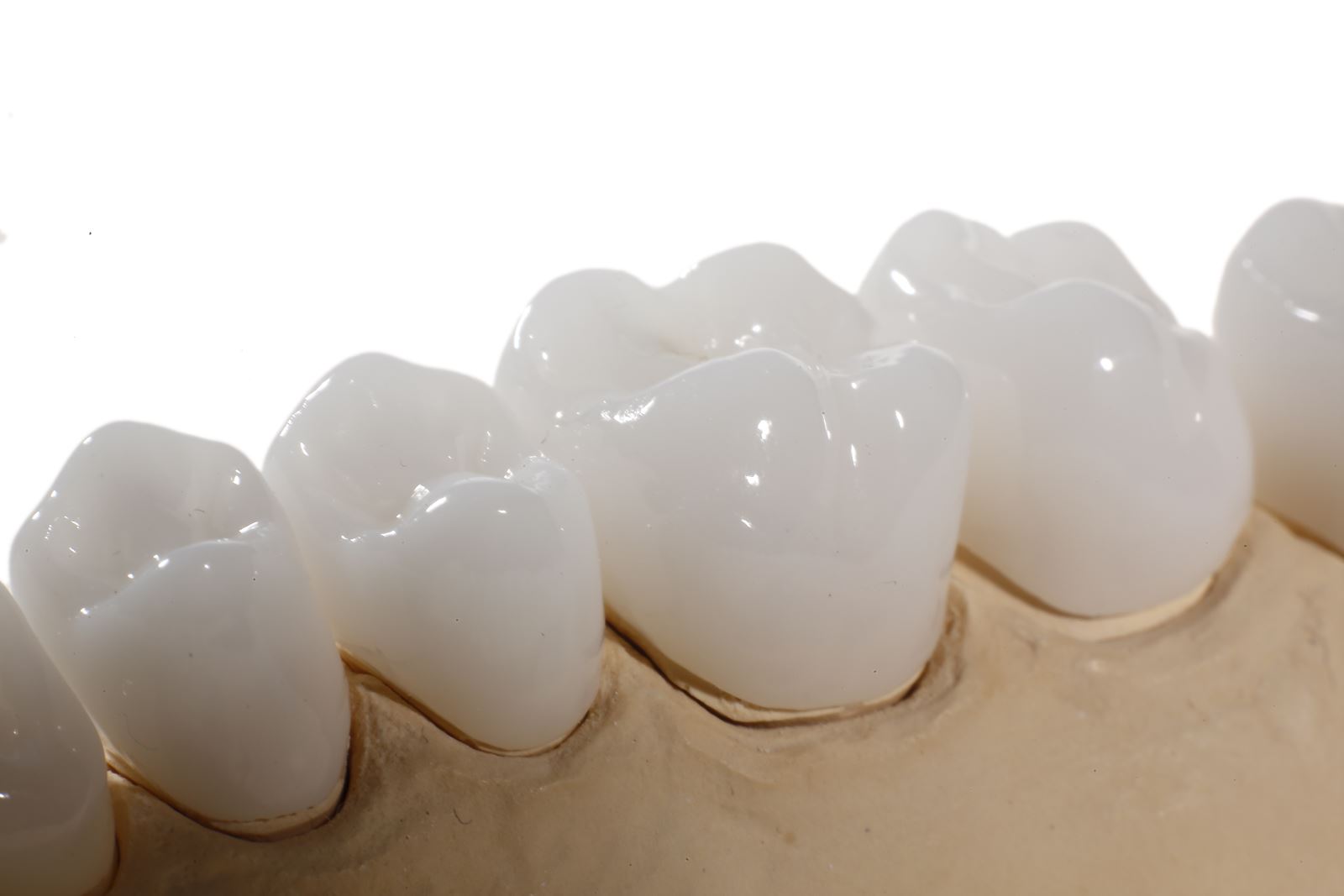 Răng sứ EMAX